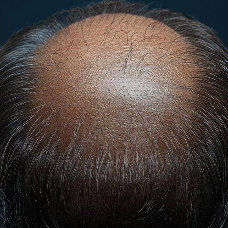 winter-park-bog-banner